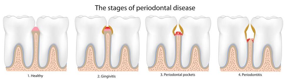 Dra. Begoña Gutiérrez Abascal Periodoncia