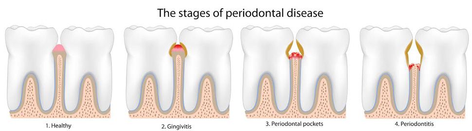 Dra. Begoña Gutiérrez Abascal Periodoncia