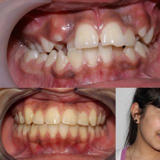 Dra. Begoña Gutiérrez Abascal Dentistas 11