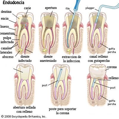 Dra. Begoña Gutiérrez Abascal Endodoncia 1