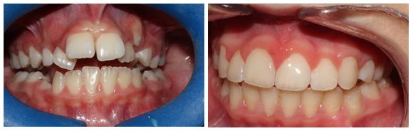 Dra. Begoña Gutiérrez Abascal Atención dental infantil